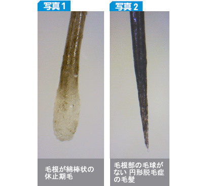 特集 異物混入対策 金属 硬質異物 毛髪編 解説 抜け毛の仕組みと毛髪混入対策 日本食糧新聞電子版