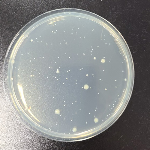 食の安全を支える微生物検査の歩み（4）微生物の培養の歴史と寒天培地