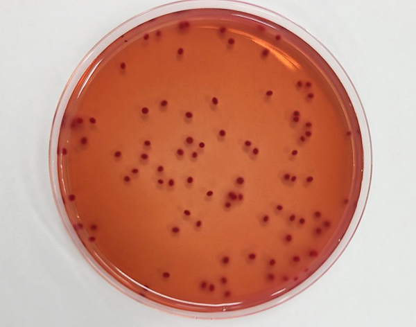 食の安全を支える微生物検査の歩み（5）微生物検査の培地の組成と培養